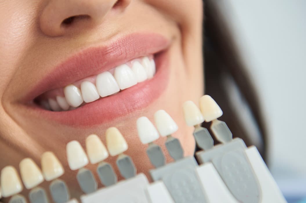 Artificial teeth locating near smiling female lips