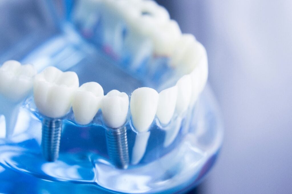 Dental teeth dentistry model