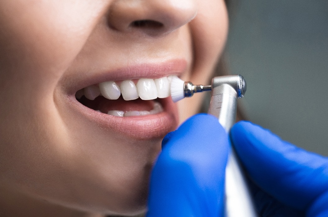 Patientin bei der professionellen Zahnreinigung