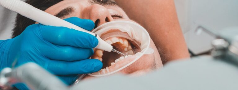 Dental practice, the dentist removes stones and hard plaque from the teeth with the help of ultrasound,patient with retractor and saliva ejector in the mouth.